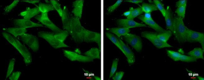 TPH1 Antibody in Immunocytochemistry (ICC/IF)