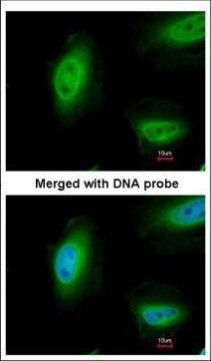 p73 Antibody in Immunocytochemistry (ICC/IF)