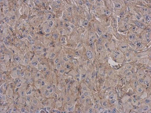 CD180 Antibody in Immunohistochemistry (Paraffin) (IHC (P))