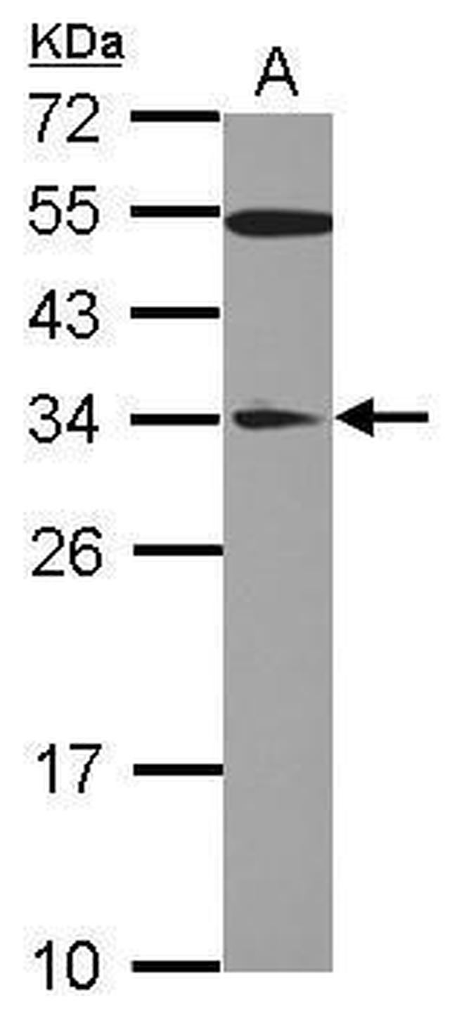 GAS41 Antibody in Western Blot (WB)