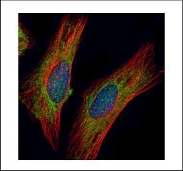 CHIC2 Antibody in Immunocytochemistry (ICC/IF)