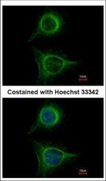 SBDS Antibody in Immunocytochemistry (ICC/IF)