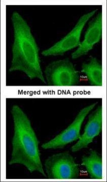 SAR1B Antibody in Immunocytochemistry (ICC/IF)