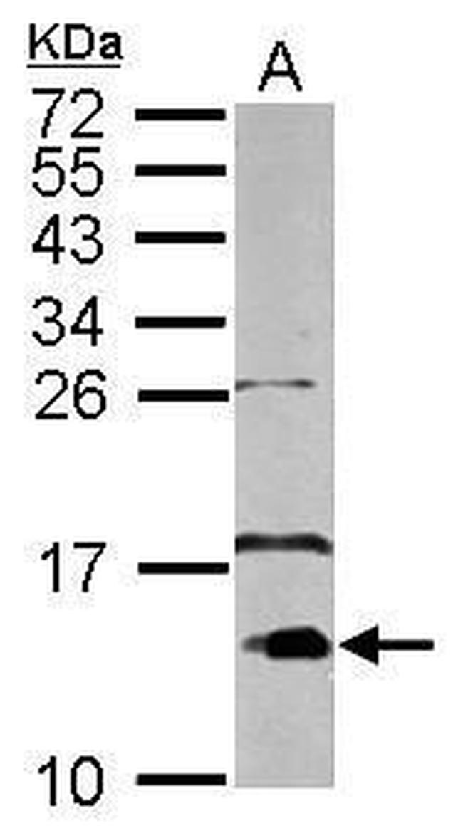 FABP3 Antibody in Western Blot (WB)