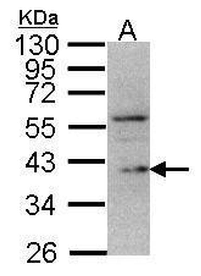 DUSP12 Antibody in Western Blot (WB)