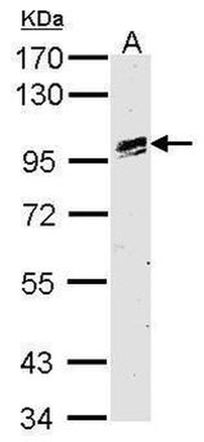 OSR1 Antibody in Western Blot (WB)