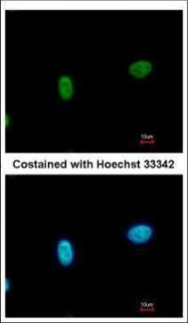 SMARCAL1 Antibody in Immunocytochemistry (ICC/IF)