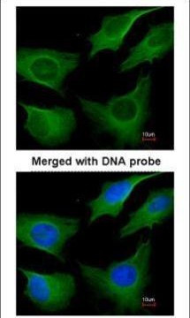 Cytokeratin 8 Antibody in Immunocytochemistry (ICC/IF)
