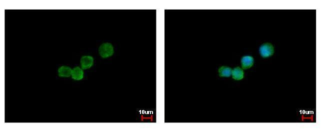 CSF3R Antibody in Immunocytochemistry (ICC/IF)
