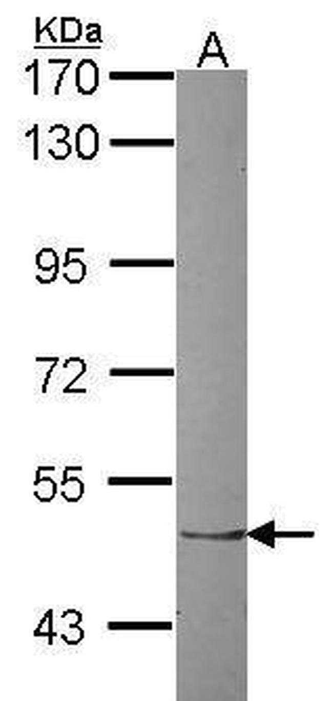 ZNF212 Antibody in Western Blot (WB)