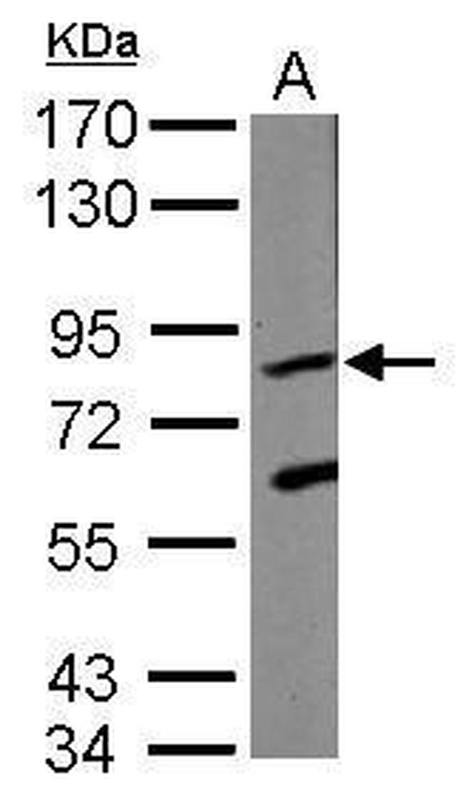 KRIT1 Antibody in Western Blot (WB)