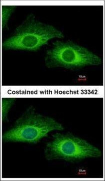 PDCD5 Antibody in Immunocytochemistry (ICC/IF)