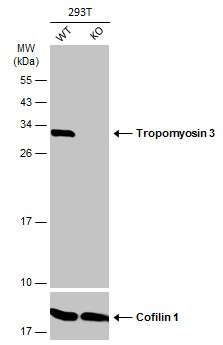 TPM3 Antibody in Western Blot (WB)