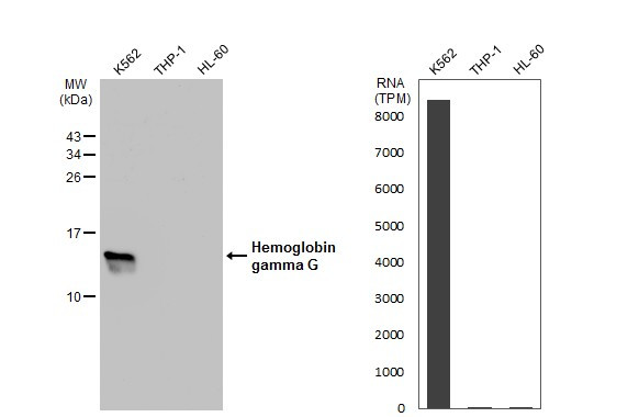 HBG2 Antibody in Western Blot (WB)