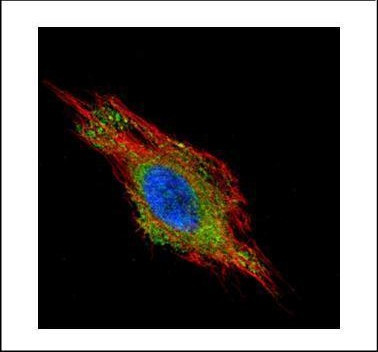 CHMP2B Antibody in Immunocytochemistry (ICC/IF)