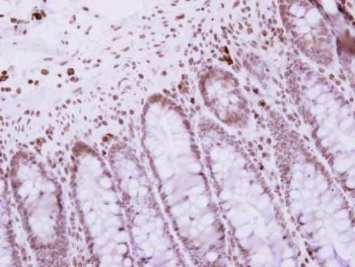 CBX4 Antibody in Immunohistochemistry (Paraffin) (IHC (P))