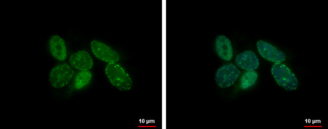 CDT1 Antibody in Immunocytochemistry (ICC/IF)