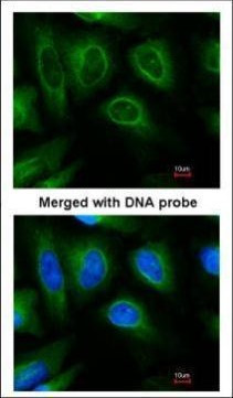 STUB1 Antibody in Immunocytochemistry (ICC/IF)