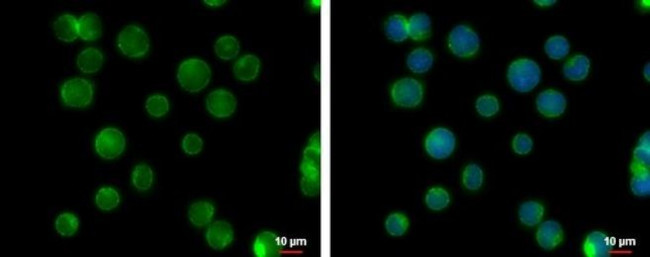 CCR2 Antibody in Immunocytochemistry (ICC/IF)