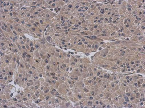APBB3 Antibody in Immunohistochemistry (Paraffin) (IHC (P))