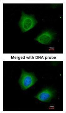 Cytokeratin 7 Antibody in Immunocytochemistry (ICC/IF)