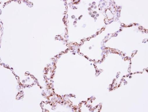 CDH11 Antibody in Immunohistochemistry (Paraffin) (IHC (P))