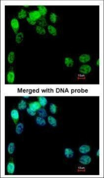 eIF2b epsilon Antibody in Immunocytochemistry (ICC/IF)