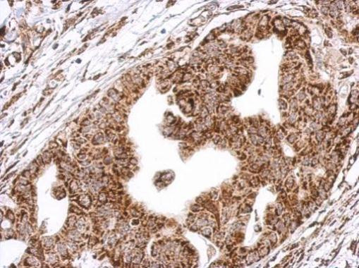 HLCS Antibody in Immunohistochemistry (Paraffin) (IHC (P))