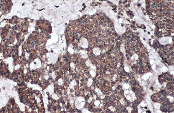 GAA Antibody in Immunohistochemistry (Paraffin) (IHC (P))