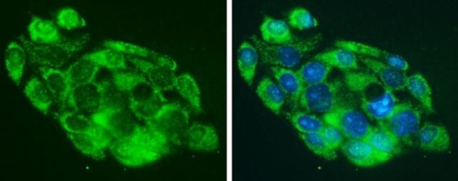 MARS Antibody in Immunocytochemistry (ICC/IF)