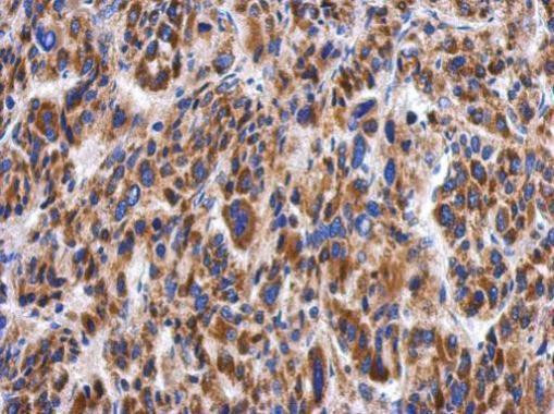 Myotilin Antibody in Immunohistochemistry (Paraffin) (IHC (P))