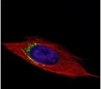 GGCX Antibody in Immunocytochemistry (ICC/IF)