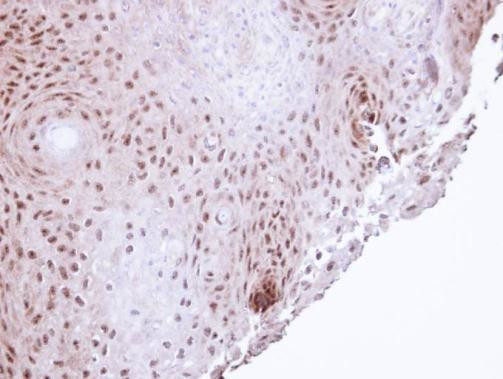 POLH Antibody in Immunohistochemistry (Paraffin) (IHC (P))