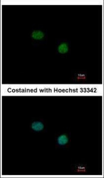 TTF2 Antibody in Immunocytochemistry (ICC/IF)