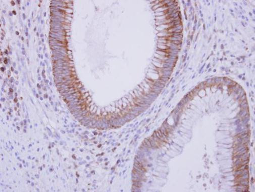 Complement C9 Antibody in Immunohistochemistry (Paraffin) (IHC (P))