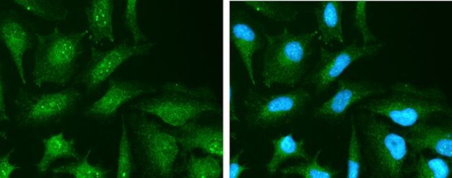GC Antibody in Immunocytochemistry (ICC/IF)
