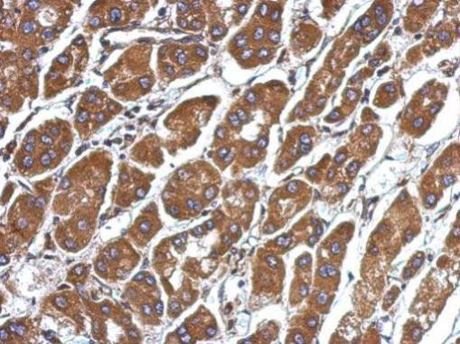 CFHR5 Antibody in Immunohistochemistry (Paraffin) (IHC (P))