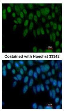 ZIC3 Antibody in Immunocytochemistry (ICC/IF)