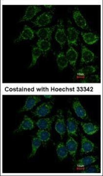 Villin Antibody in Immunocytochemistry (ICC/IF)