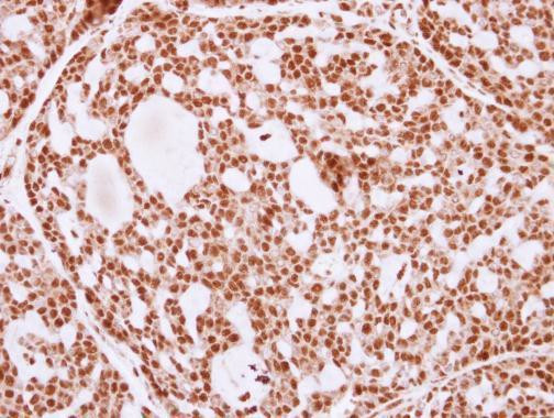 Ku80 Antibody in Immunohistochemistry (Paraffin) (IHC (P))