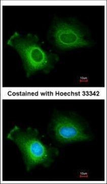 CYP2R1 Antibody in Immunocytochemistry (ICC/IF)