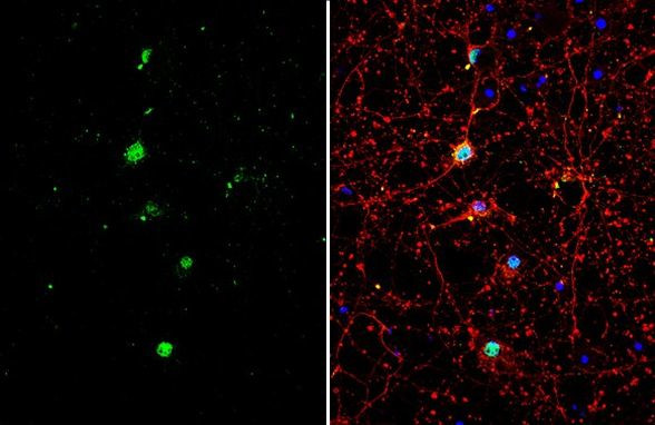 TLE1 Antibody in Immunocytochemistry (ICC/IF)