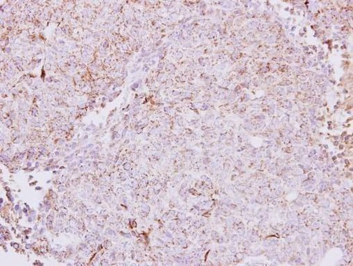 CETP Antibody in Immunohistochemistry (Paraffin) (IHC (P))