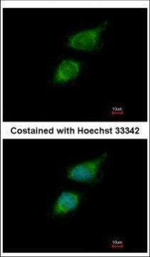 Tara Antibody in Immunocytochemistry (ICC/IF)