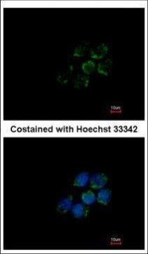 ALDH5A1 Antibody in Immunocytochemistry (ICC/IF)