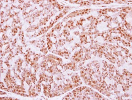 FANCE Antibody in Immunohistochemistry (Paraffin) (IHC (P))