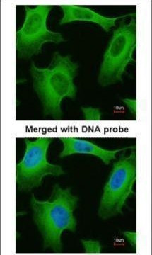 PLA2G4A Antibody in Immunocytochemistry (ICC/IF)
