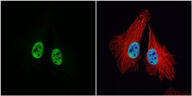 MCM3 Antibody in Immunocytochemistry (ICC/IF)