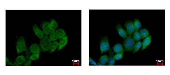 ATP6V0A4 Antibody in Immunocytochemistry (ICC/IF)