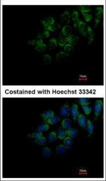 DMP4 Antibody in Immunocytochemistry (ICC/IF)